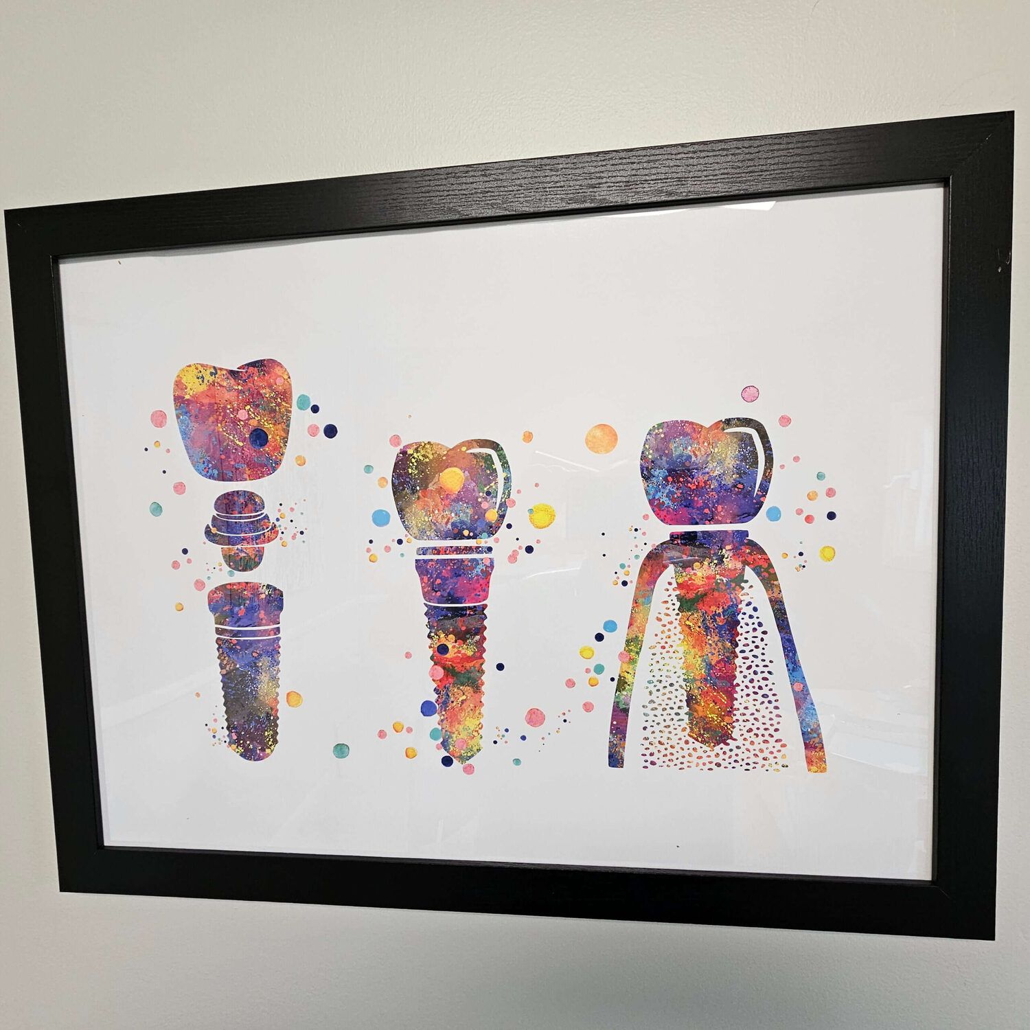 dental implants, tooth implant, full mouth dental implants, full dental implants, implant restoration, single tooth implant, replace missing teeth